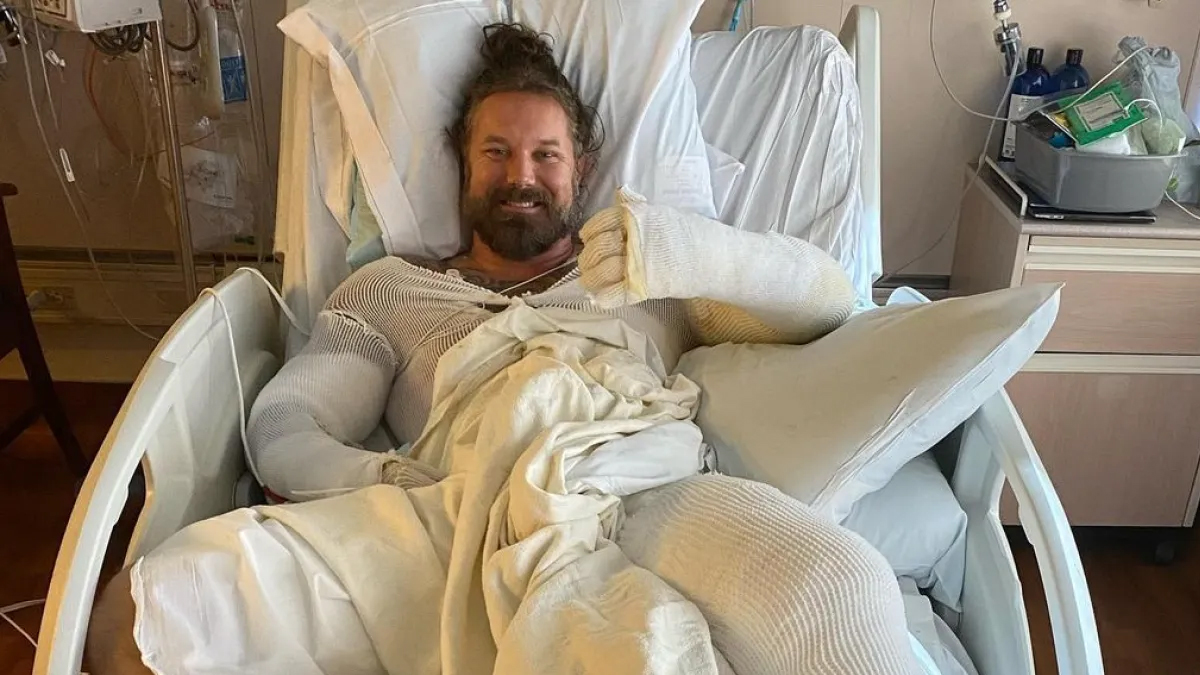 AS I LAY DYING’S TIM LAMBESIS OFFERS UPDATE FOLLOWING BONFIRE ACCIDENT